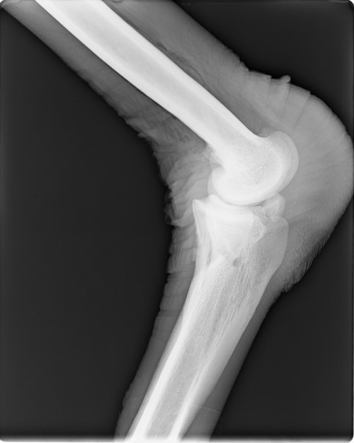 Ankle- note the big calloused pad that ostriches rest on (right side of image).